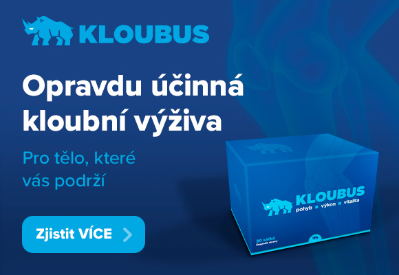 kloubus